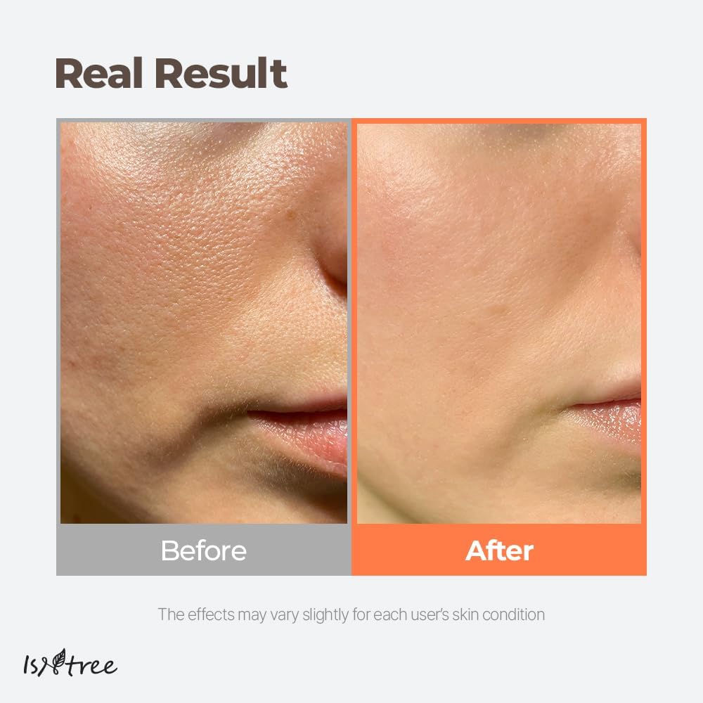 Isntree Green Tea Fresh Toner 200ml — Toners & Astringents product image 52