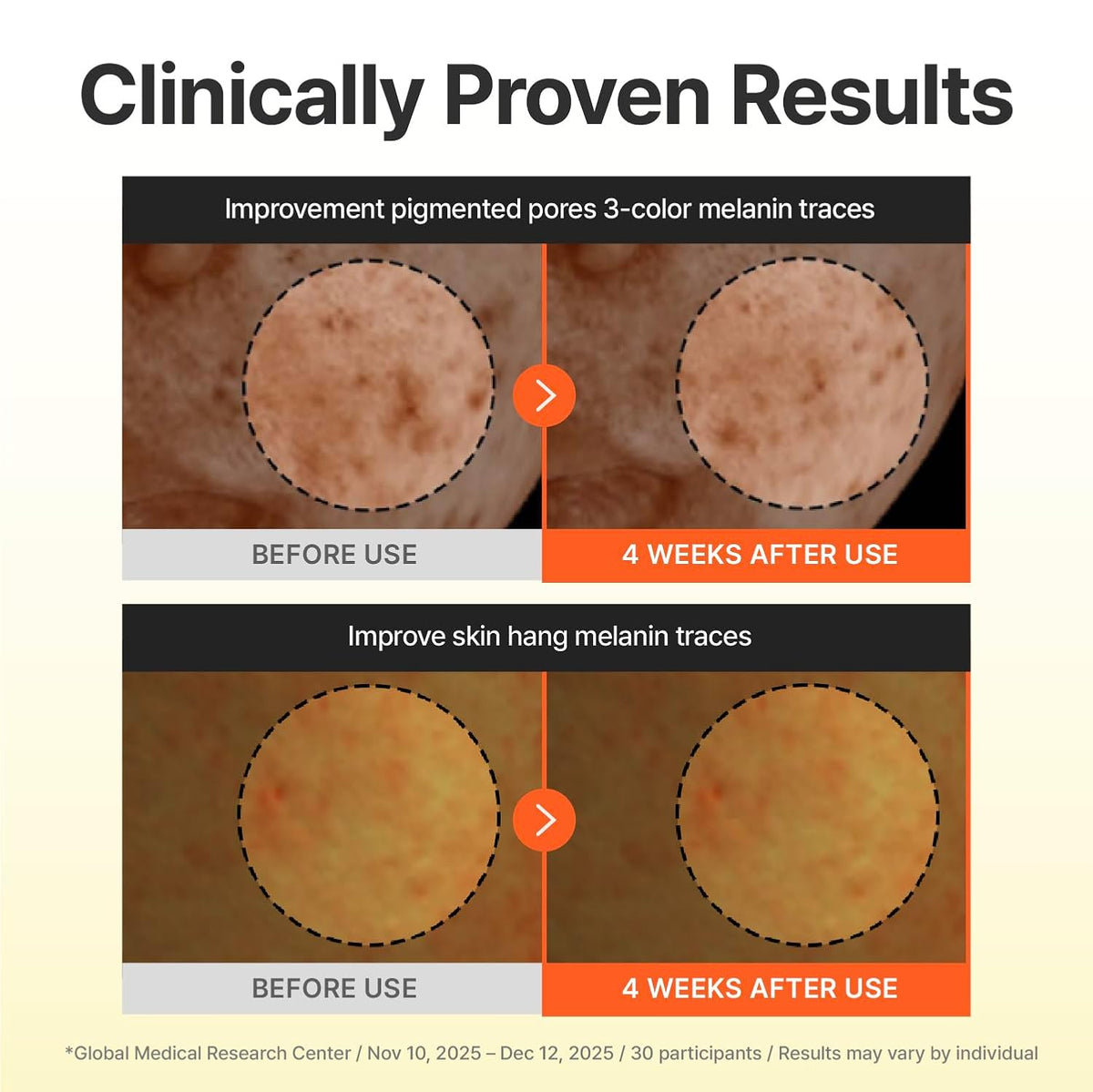 Centellian24 Madeca Vitamin 15+ Glowing Serum 30ml — product detail image 5