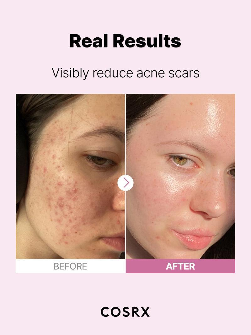 COSRX The Niacinamide 15 Serum 20ml — product detail image 8