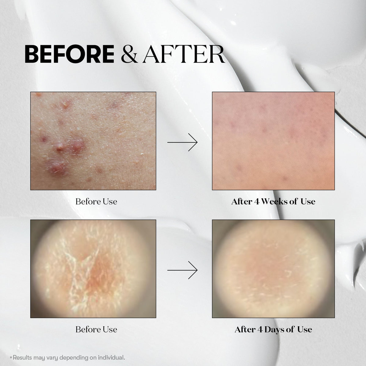 VT Cosmetics Reedle Shot 100 30ml - official product image 5